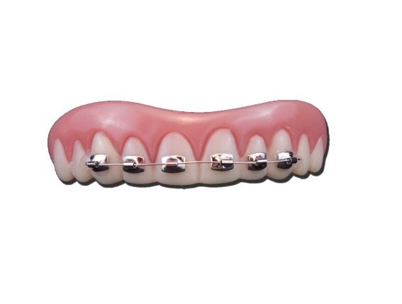 fake teeth with braces